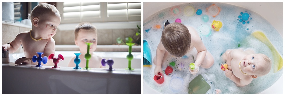 Detox Baths for Kids | How to Cure the Ickies